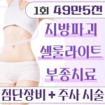 허벅지.복부.등.팔 셀룰리스. 지방분해주사&초음파지방분해&충격파지방분해. 지방성형