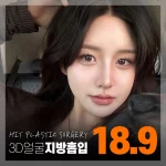 히트_3D얼굴지방흡입