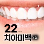 1-DAY 치아미백 3회 풀코스