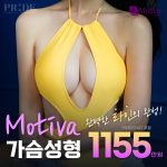 모티바 가슴성형