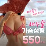 프라이드 가슴 재수술